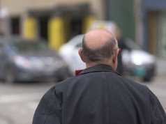 Consigli contro la caduta dei capelli: metodi Consigli contro la caduta dei capelli