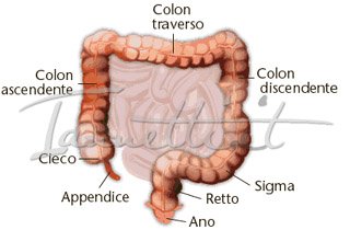 cancro intestinale
