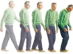 Morbo di Parkinson: sintomi diagnosi e cura