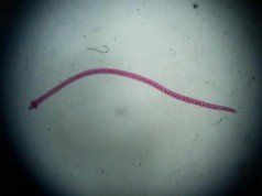 Il parassita che trasmette il tumore